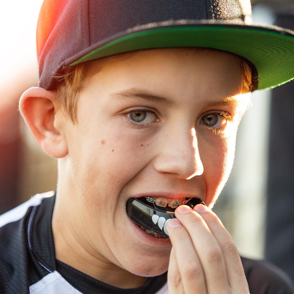 Braces Compatible Mouthguard - Trans Black / White Fang